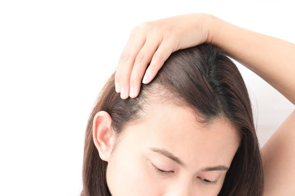 afinamento capilar queda de cabelo tratamento para queda de cabelo queda capilar produtos para queda de cabelo